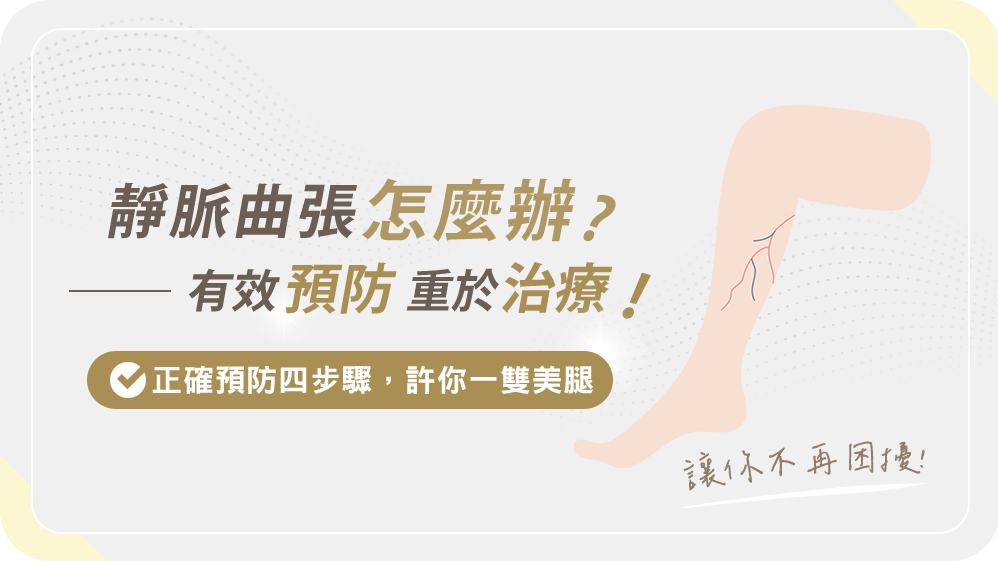 靜脈曲張怎麼辦?『有效預防』重於治療!