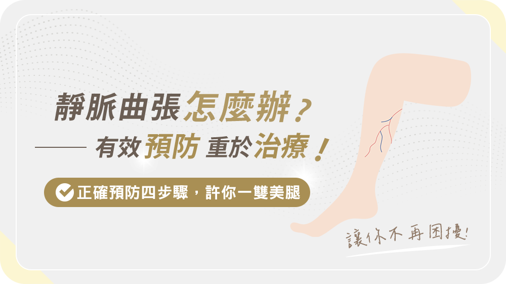 靜脈曲張怎麼辦？『有效預防』重於治療!